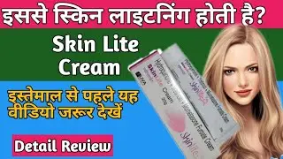 Skin Light Cream - Uses, Side-effect, Protection, Benefit, Doctors Review.. In Hindi