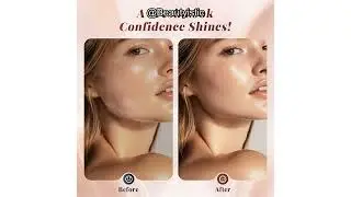 Dermaplaning Tool for Women Pink Review: Smooth Skin & Peach Fuzz Removal with Sonic Edge