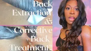 Back Extraction and Corrective Back Facial/ Treatment!