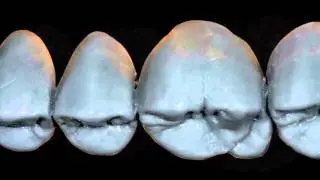 Natural Way by LSK121 Oral Prosthetics