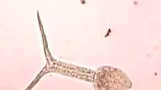 cercaria of schistosoma mansoni