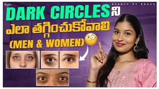 Dark Circles Treatment for Men & Women | Causes + Skincare + Home Remedies in telugu| Beautybybhavs 