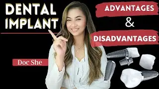 DENTAL IMPLANTS ADVANTAGES AND DISADVANTAGES / PROS AND CONS of DENTAL IMPLANTS