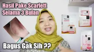 FINALLY! REVIEW SKINCARE SCARLETT WHITENING || PEMAKAIAN 3 BULAN RUTIN. GIMANA HASILNYA?