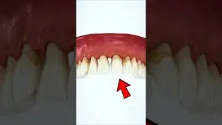 E se NON ti lavassi MAI PI&Ugrave; i DENTI? - Edonikko