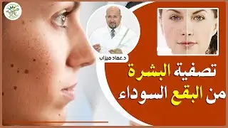 تصفية البشرة من البقع السوداء - الدكتور عماد ميزاب imad mizab