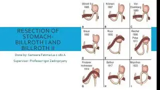 Resection of stomach by Sameera Fatima