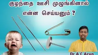 குழந்தை ஊசியை விழுங்கினால் ஆபத்தா?  Child swallows safety pin - Endoscopy removal - Dr AC Arun Tamil