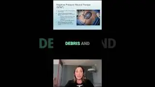 Exploring Negative Pressure Wound Therapy: Essential Guide 🎥