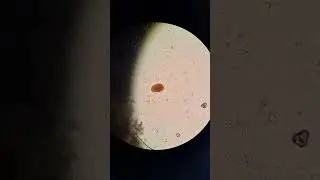 stool preparation #lab #medlab #medicaltest #science #bloodtest