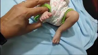 رحلة الطفل الجميل تميم (حالة قدم مخلبية)