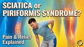 Sciatica vs. Piriformis Syndrome: Which One Do You Have? (& How to Fix It)