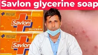 savlon glycerin soap full Review//savlon glycerin soap ke fayde//savlon soap