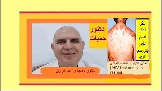 Тест на ВИЧ и кожная сыпь