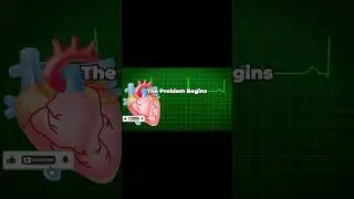 heart attack #nurse #ytshorts #science #youtuber#viral #health #heartattack #heartdisease #doctor