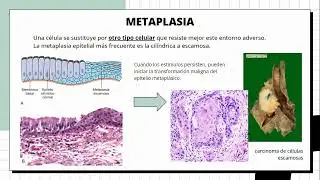 Seminario 2   Adaptacion, lesion y muerte celular