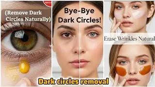 Remove Dark Circles Permanently in 7 Days | Extreme Dark Circles Remedy | 100% Results