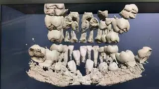 Real-time GPU-based 3D-CT Spatial Reality Viewer