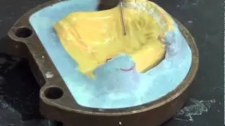 08 Temporary RPD denture processing