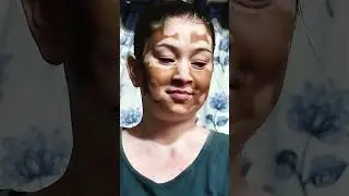 Your skin is not your weakness &mdash; it&rsquo;s your power
