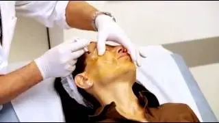 Aliaxin SR Face, Neck part1