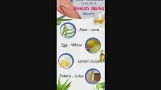 Stretch Marks: Why they appear and how to deal of them