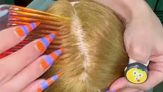 Gentle Scratch & Scrape: Long Nails Dandruff Removal (ASMR Scalp) IMG 6152