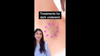 How to treat dark underarms | Swati Kannan MD #shorts