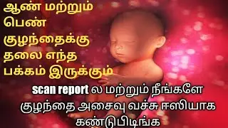 Symptoms in baby head position during pregnancy right or left boy or girl baby Tamil....