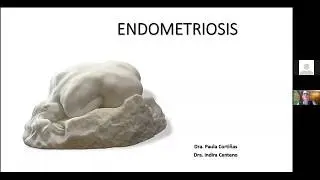 Endometriosis