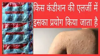 Avil 25 Tablet use in Hindi side effect पूरी जानकारी देंगे इस वीडियो में