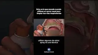 As&iacute; se descongestiona tu nariz con los sprays nasales de soluci&oacute;n salina
