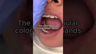 Thinking about getting braces that won&rsquo;t clash with your #OOTD? ✨