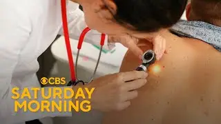 Dermatologists battle online 
