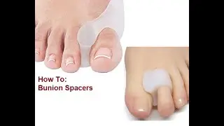 How To: Bunion Spacers/ Bunion Shield