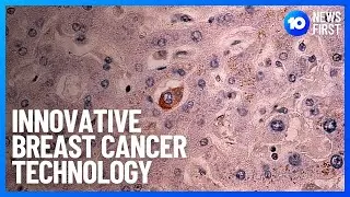 Breast Cancer Detection Technology Breakthrough | 10 News First