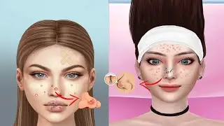 ASMR Hospital Doctor Game|| Walkthrough All Game Level 1