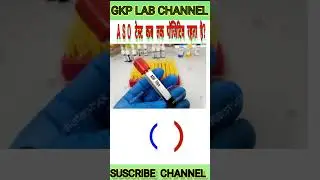 ASO Test Joint pain test report #shorts #lab #aso #shadi shadi #gk