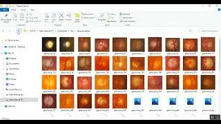 Dynamic Inductive Transfer Learning with Decision Support Feedback to Optimize Retina Analysis