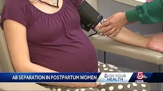 How to see if your abs separated after a pregnancy