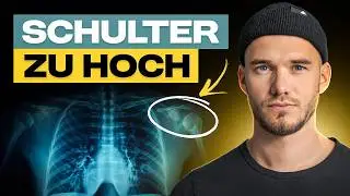 Schiefe Schultern? DAS ist der wahre Grund (und niemand sagt es dir!) für einen Schulterhochstand