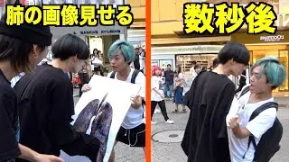 【お前らの肺は汚い】タバコ吸ってる奴に汚い肺の写真を見せてあげたら案の定ブチギレられた。