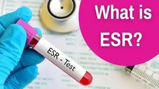 which Anticoagulant is best for esr,Anticoagulant for esr, sodium citrate, EDTA #drnajeeb