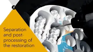 Sagemax explains: Separation and post processing of the restoration