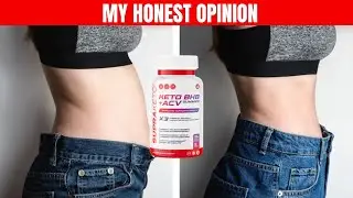 Supra Keto Gummies Review 🇨🇦: Best Keto ACV Gummy for Weight Loss? (2026)