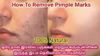 In One Days - Remove pimple Marks / Acne Marks / Black spots / Dark spots Fast At Home