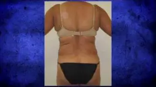Struggling To Lose Last Ten Pounds