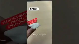 Patella bone siding