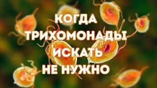Трихомонады: в каких случаях их НЕ нужно искать#трихомонады #доказательнаямедицина #doctorberezovska