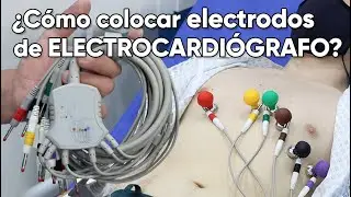 ¿Cómo colocar los electrodos de un electrocardiógrafo?